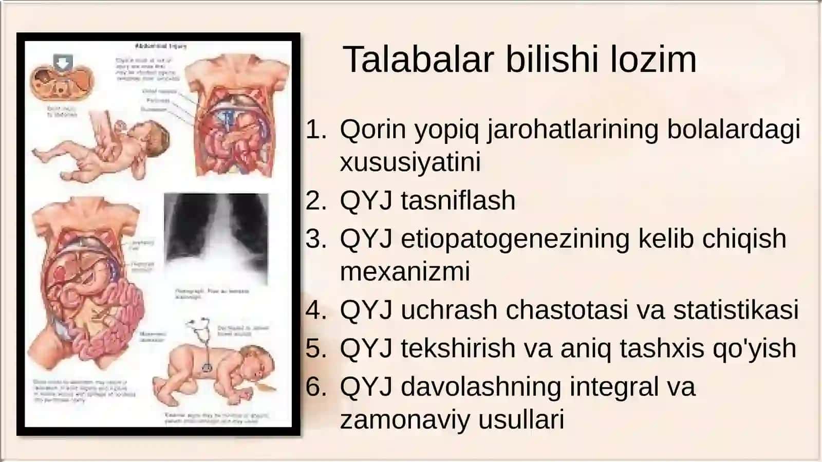qorin yopiq jaroxatlarining o'zgaxsosligi va davolash prinsiplari 3
