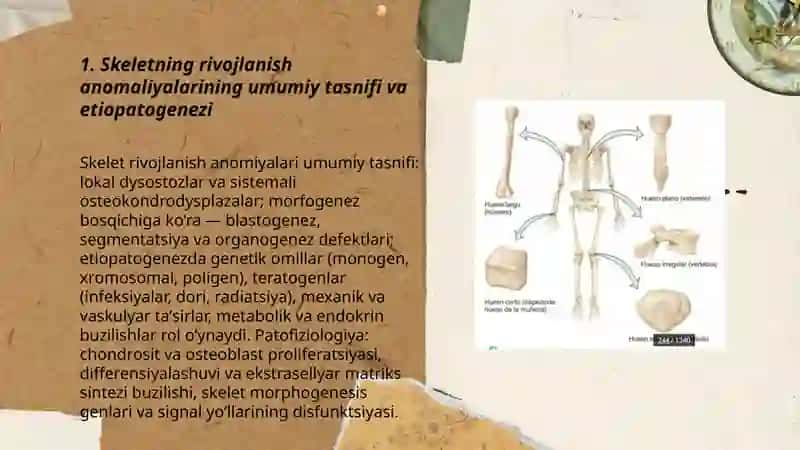 Skeletning rivojlanish anomaliyalari 3