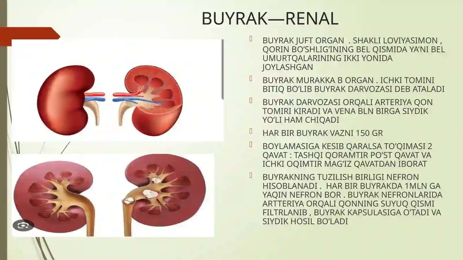 siydik ayirish aʼzolarining rivojlanish nuqsonlari 3
