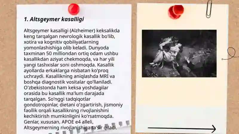 Altsgeymer kasalligi 3