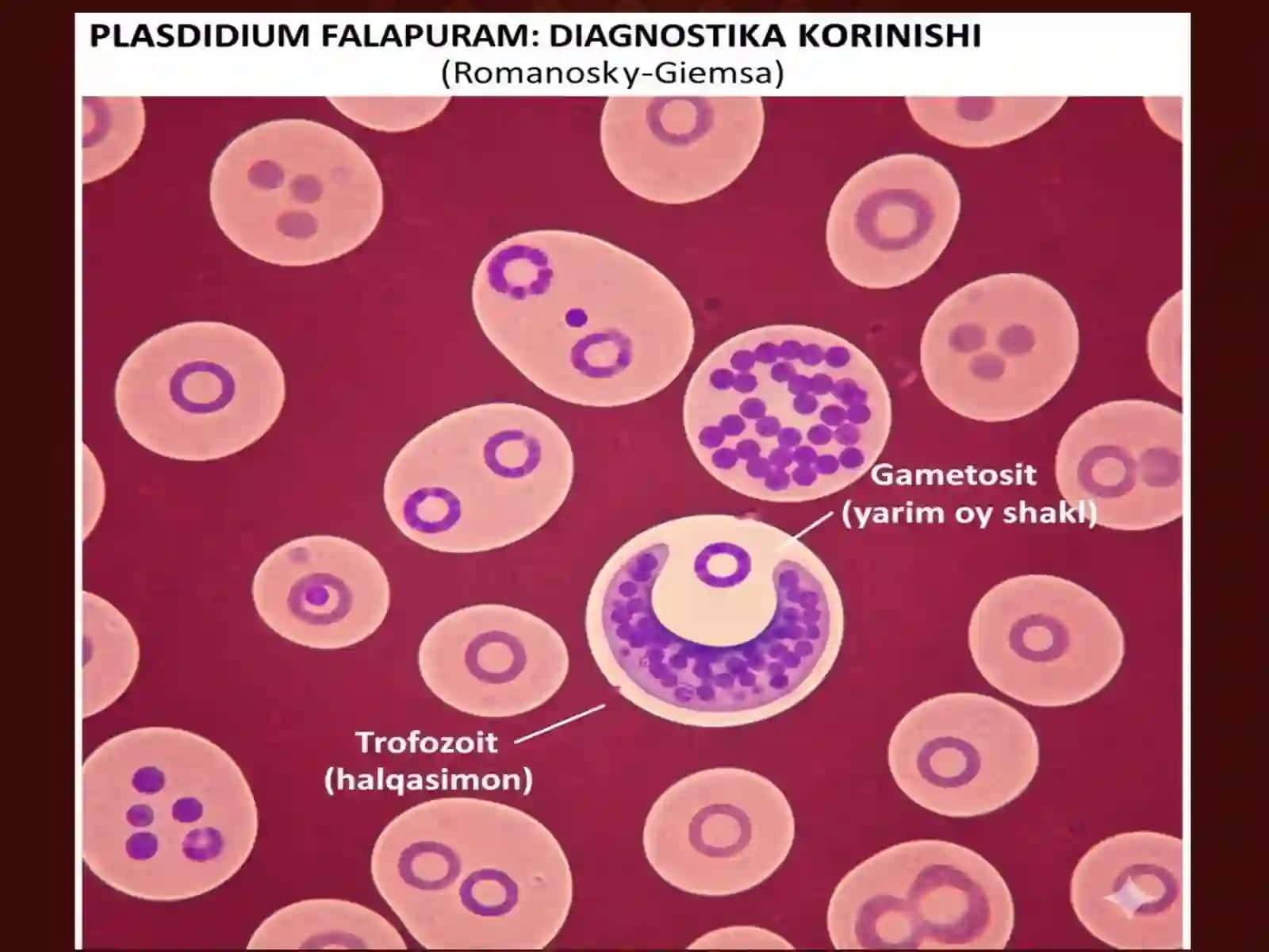 ENDOGEN PARAZITLAR KASALLIKLARI: KLASSIFIKATSIYASI, PATOGENEZI VA LABORATORIYA TASHXISI taqdimot 3