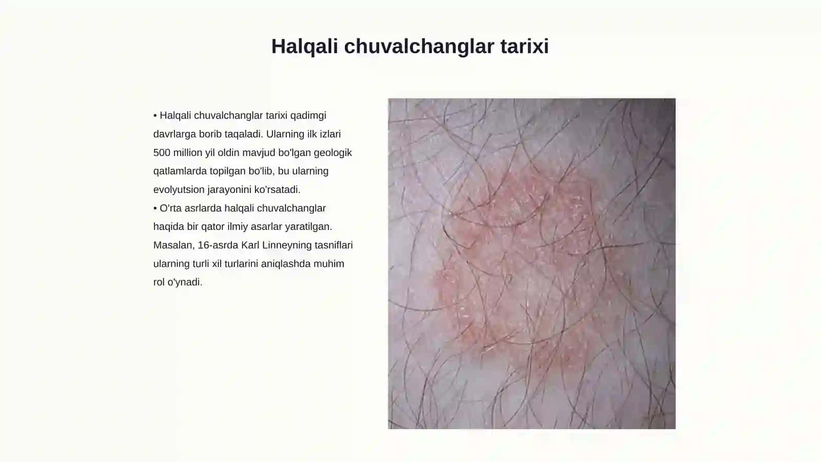 Halqali chuvalchanglar tipi 3