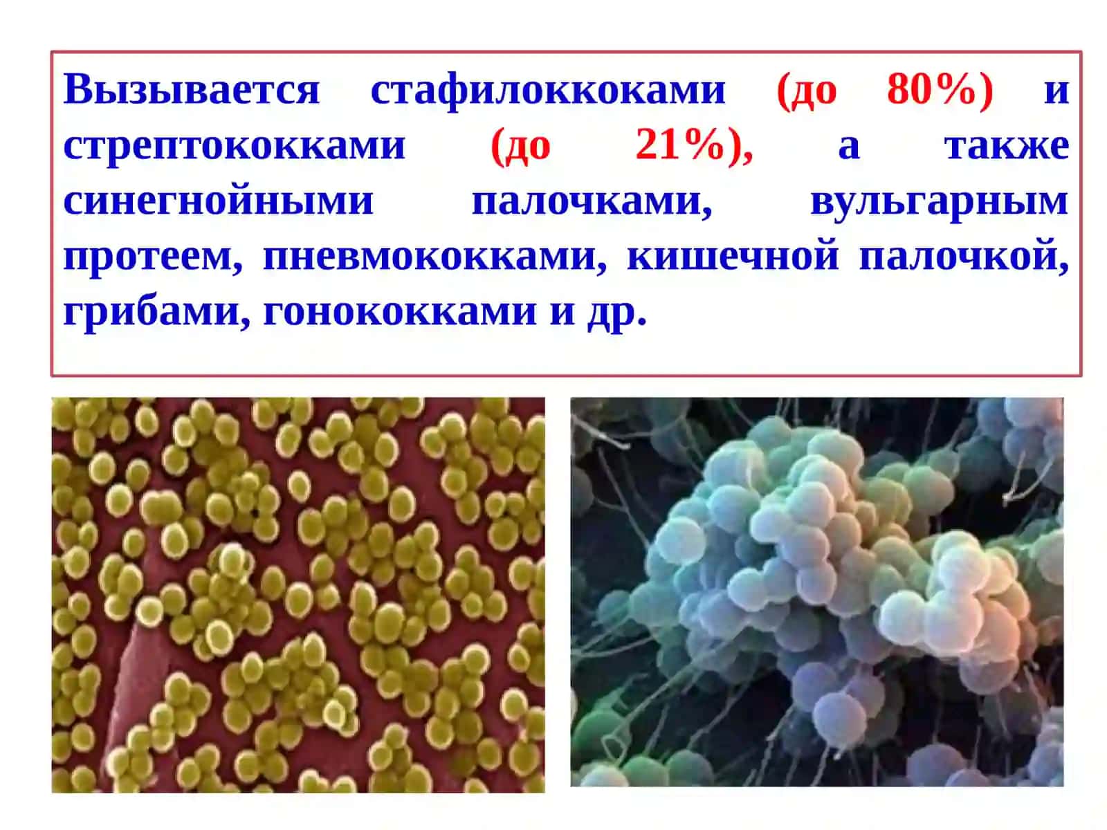 Пиодермии 3