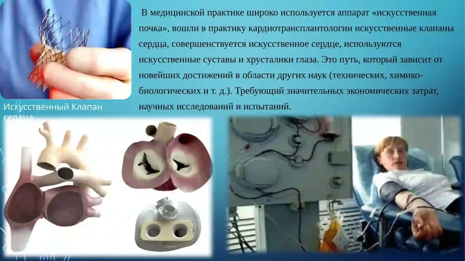 Проблемы создания искусственных органов для трансплантологии 3