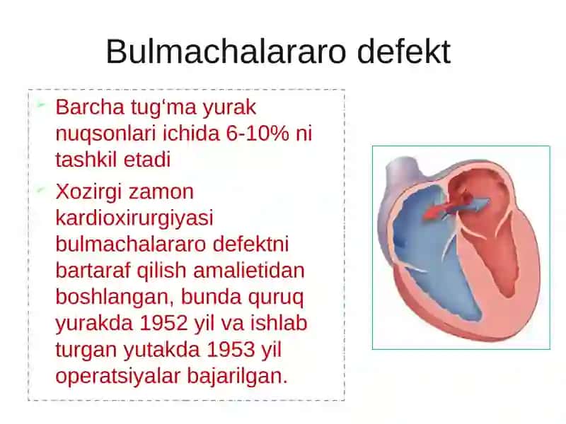 Tug'ma yurak nuqsonlari 3