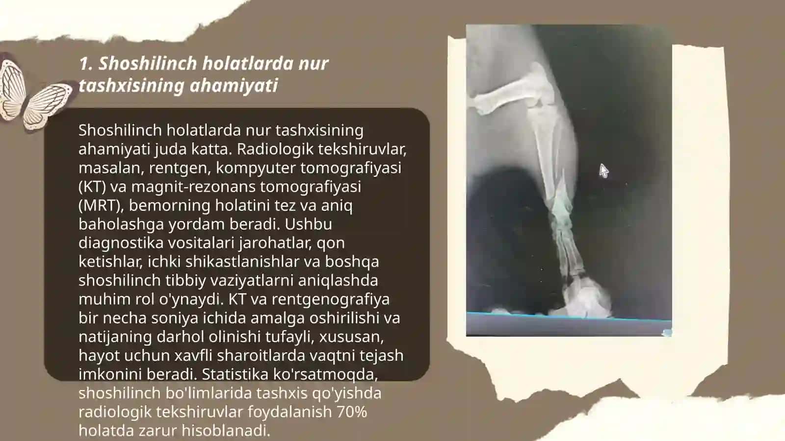 Shoshilinch holatlarda nur tashxisi 3
