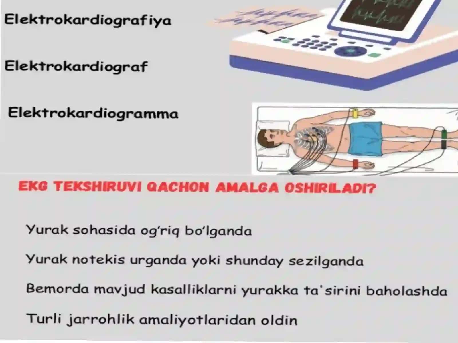 Chaqaloqlarda EKG ning xususiyatlari 3