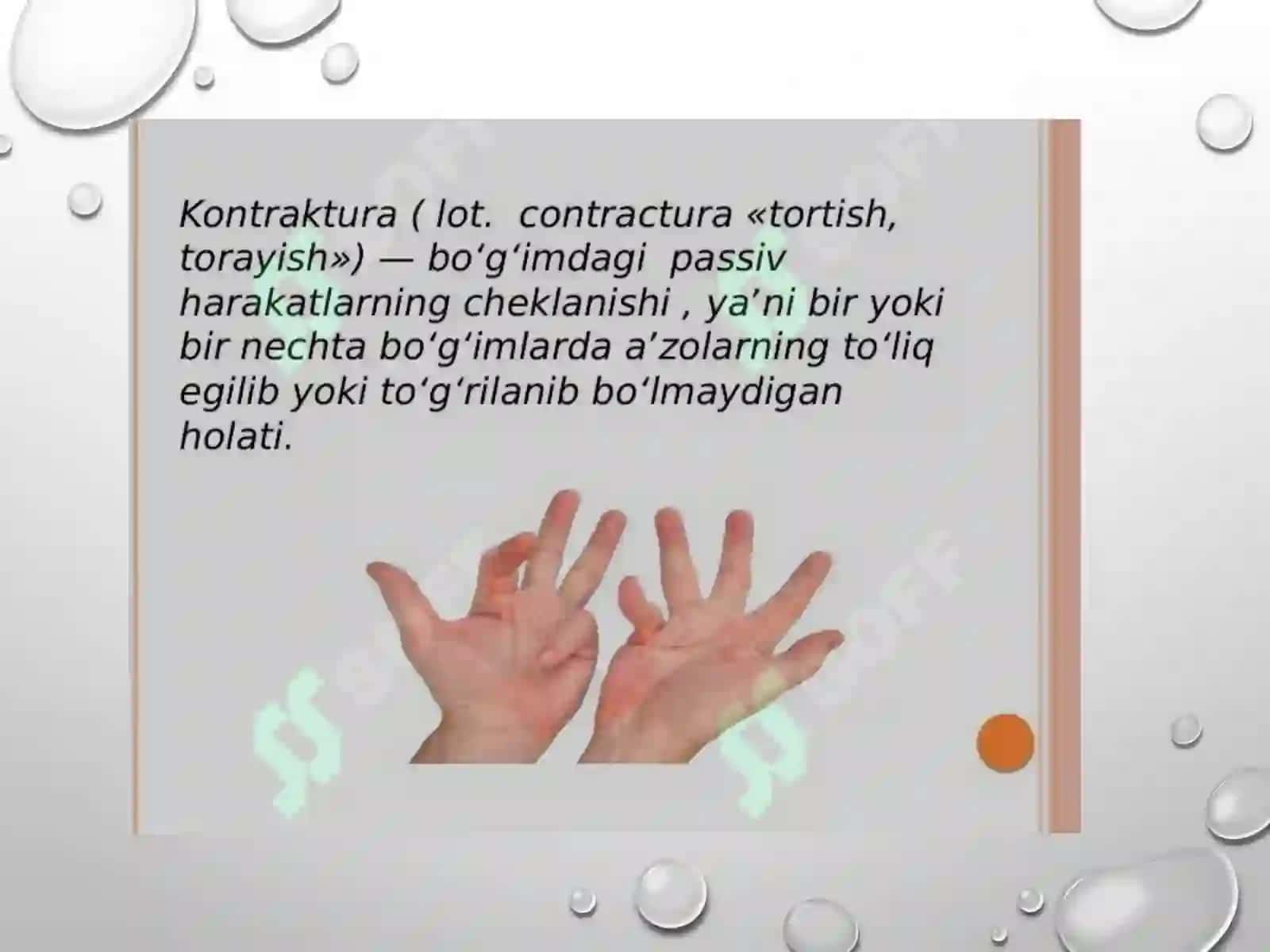 Oyoq panjasi statik deformatsiyalari 3