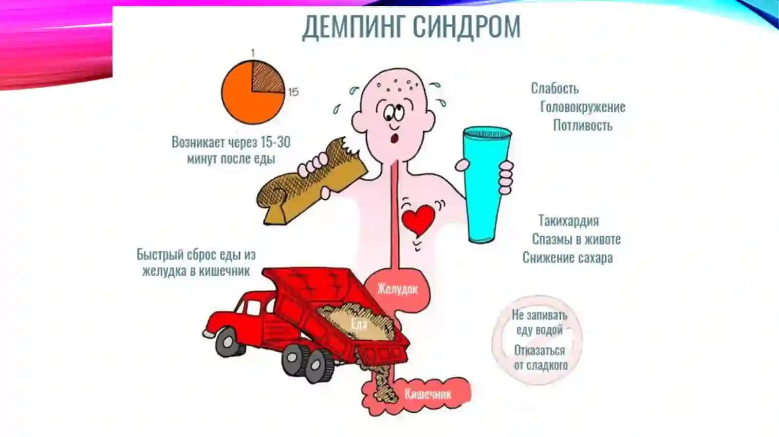Dempingsindromi, Peyts-Egerssindromi, Menetrekasalliginingdiagnostikmezonlari 3
