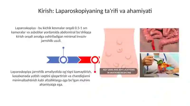 Laparoskopiyaning jarrohlikda qoʻllanilishi 3