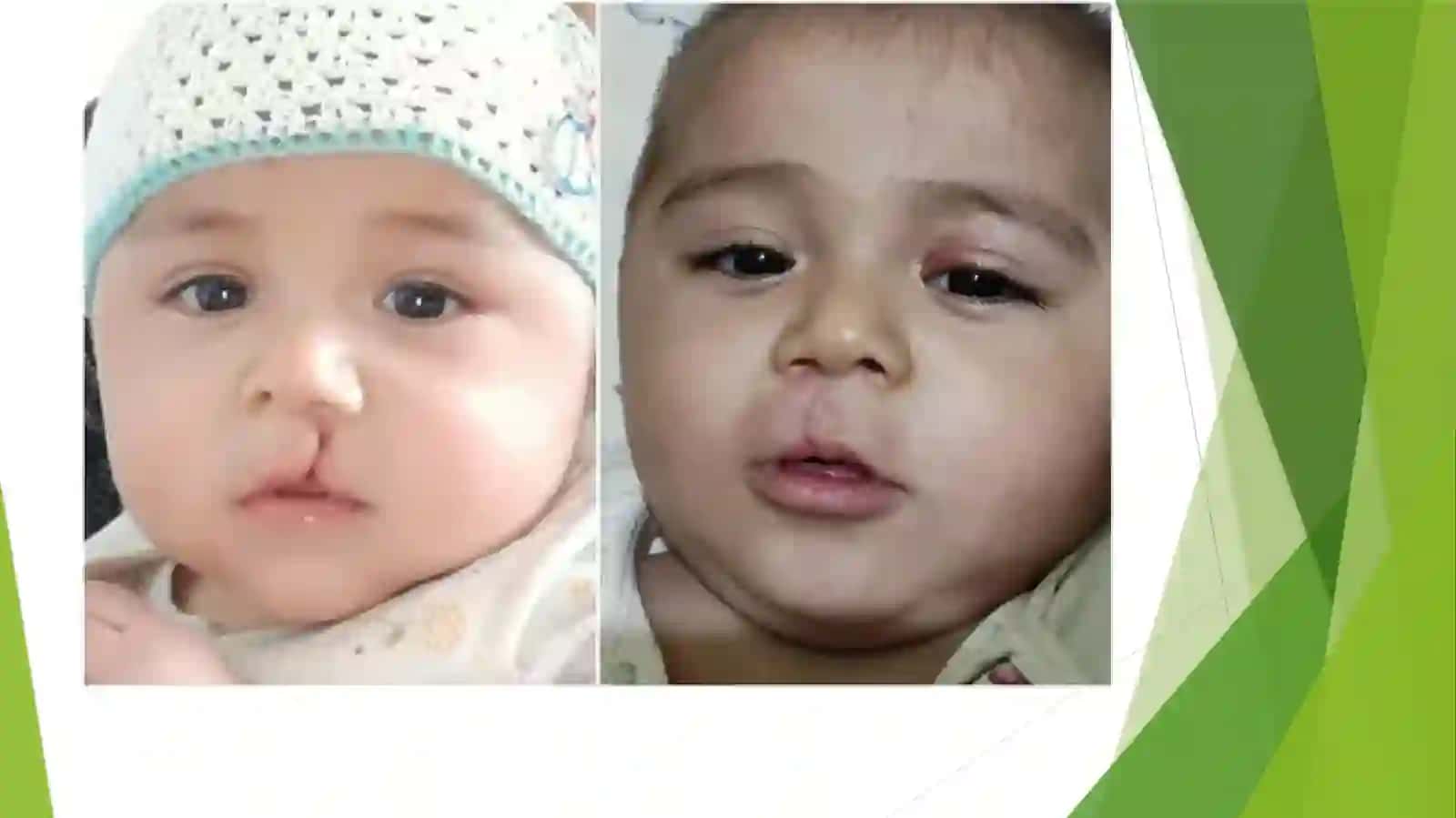 EMBRIOLOGIK ASOSLARI (JUDA MUHIM!) 3