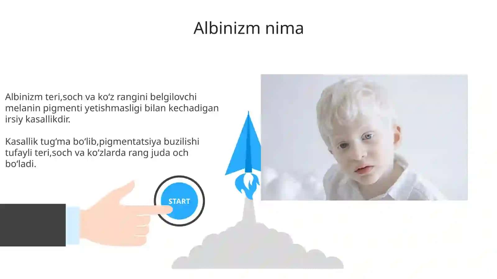 Albinizmkasalligi 3