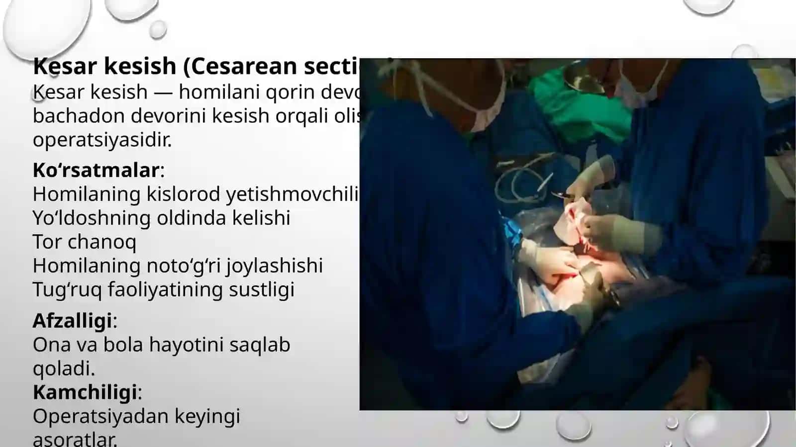 Tugʻruqni amalga oshiruvchi operatsiyalar | Kesar kesish, akusherlik qisqichlari, vakuum-ekstraksiya 3