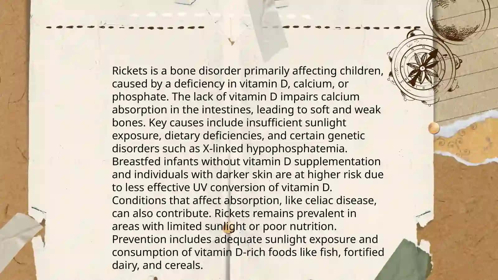 Rickets 3