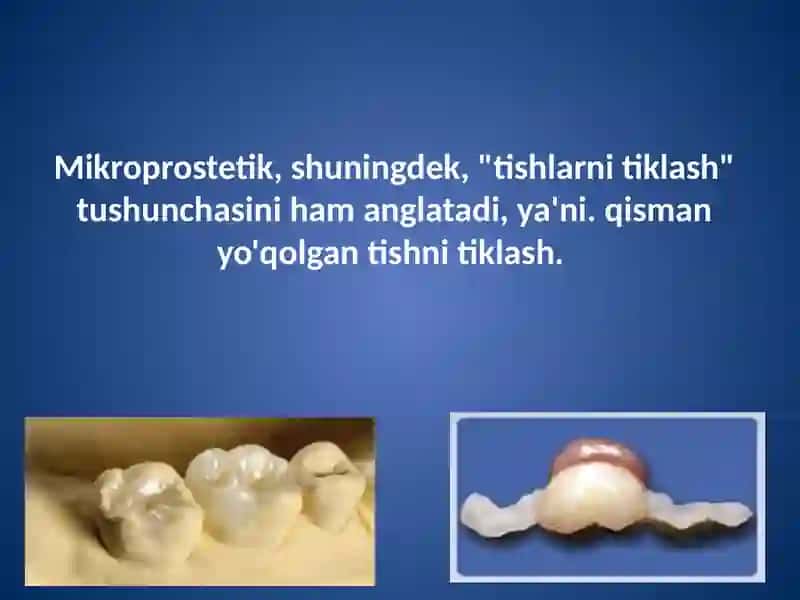 Vinirlarni tayyorlashning zamonaviy usullari 3