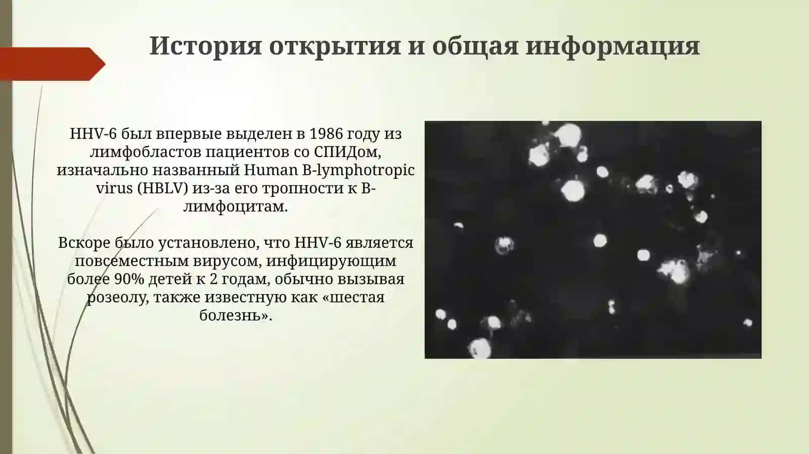 Инфекция герпеса человека 6-го типа 3