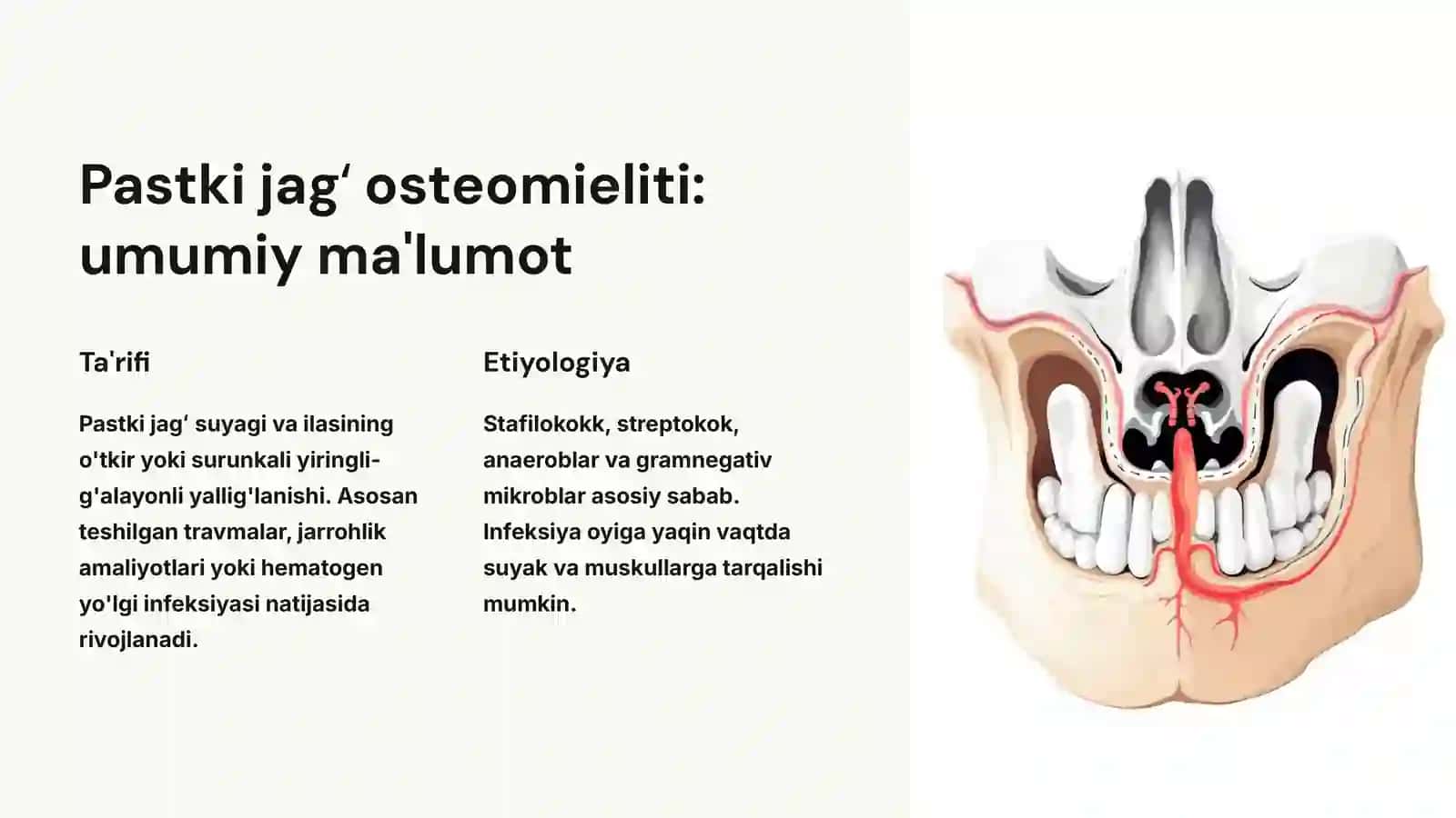 Pastki jagʻ osteomielitida boʻyin va koʻks atrofidagi tarqalgan yiringli asoratlar 3