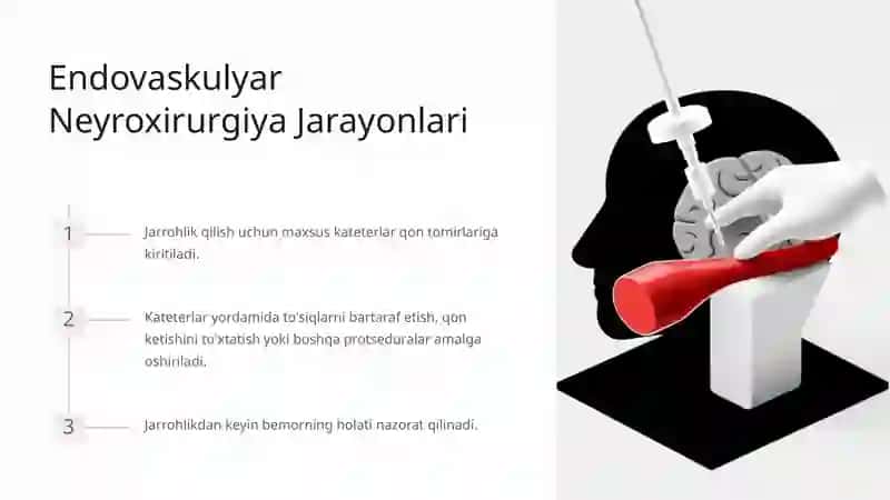 Endovaskulyar Neyroxirurgiya 3
