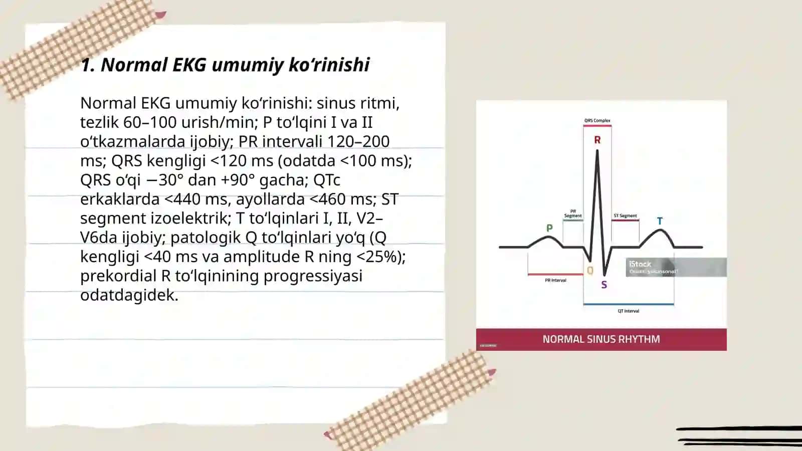 Normal EKG 3