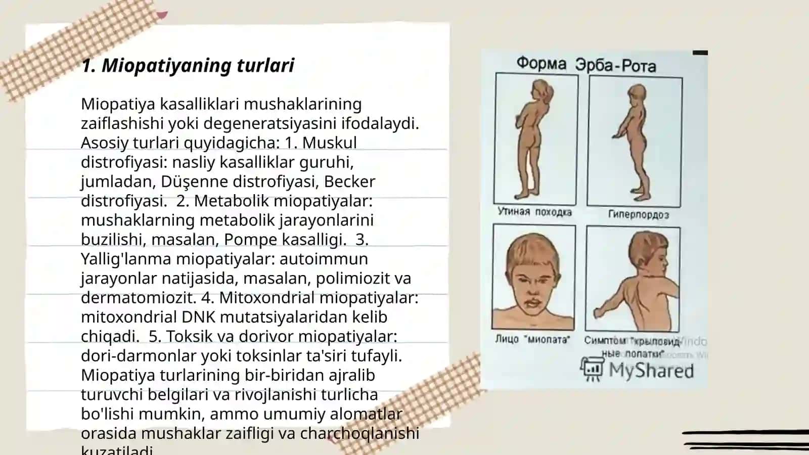 Asab tizimining nasliy kasalliklari miopatiyalar 3