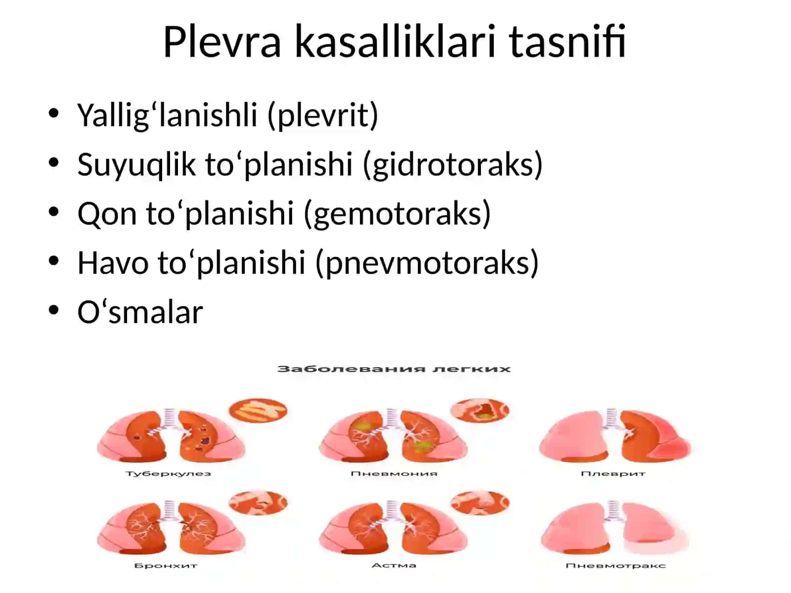 plevra kasalliklari 3