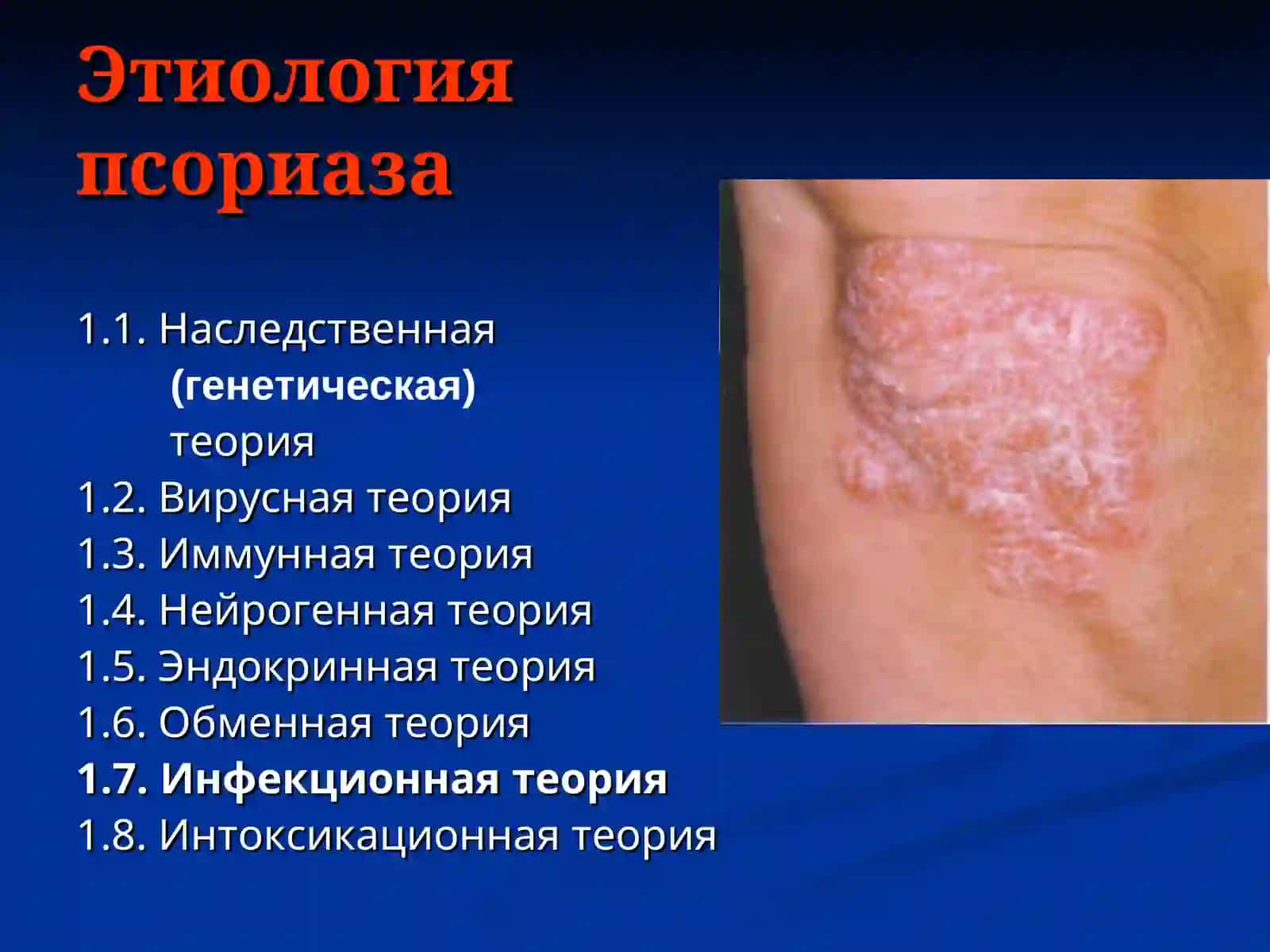 Псориаз 3