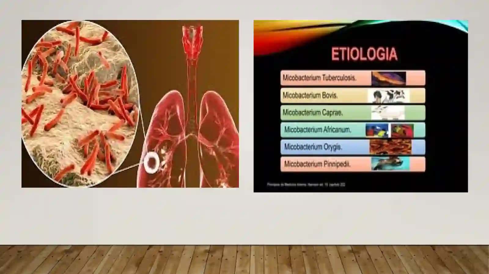 Tuberkulyozetiologiyasi va dorilarga chidamli turlari 3