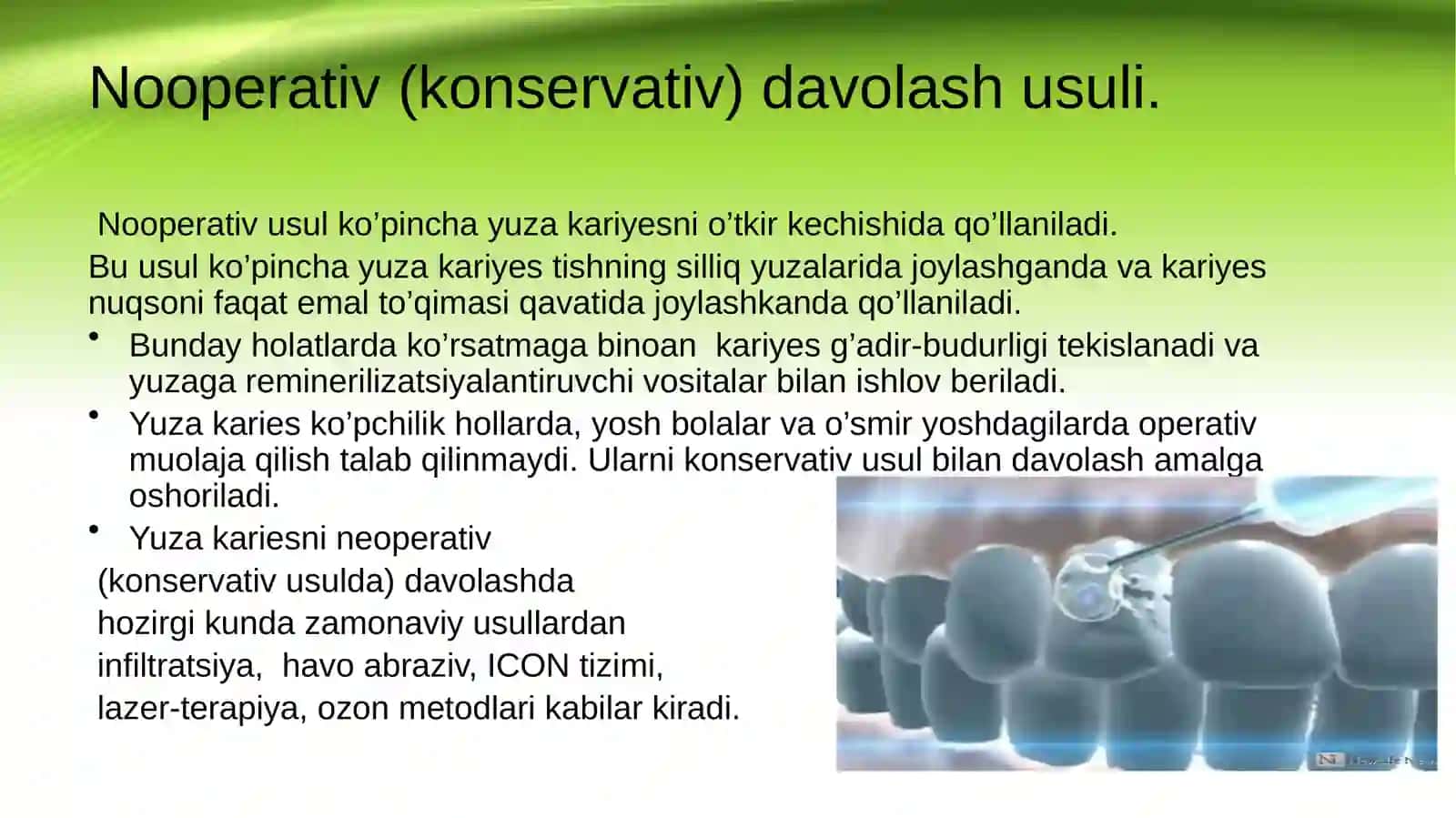 Yuza kariesni klinik kechishi va shakliga qarab davolash 3