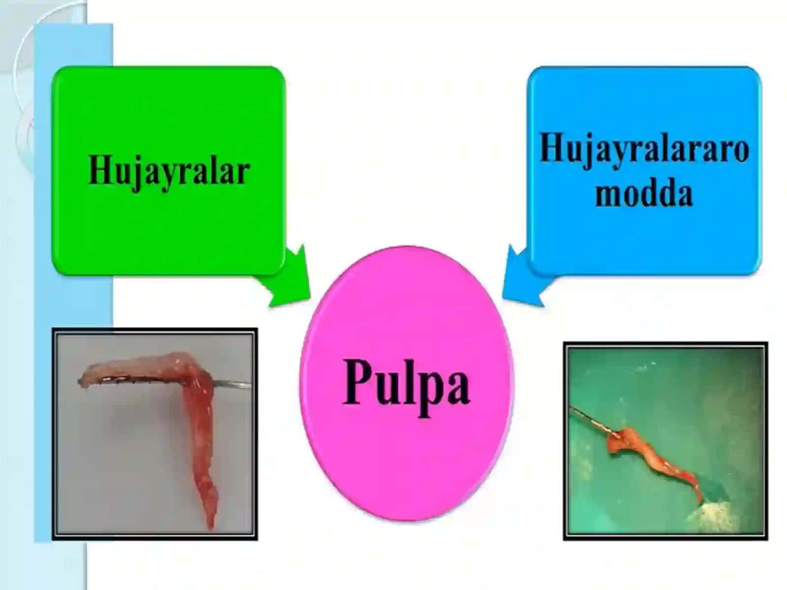 Pulpitlar.TasnifiEtiologiyai.Patogenezi 3