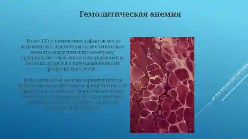 Особенности метаболизма лейкоцитов Виды и причины анемии Заболевания факторов свертывания крови 3