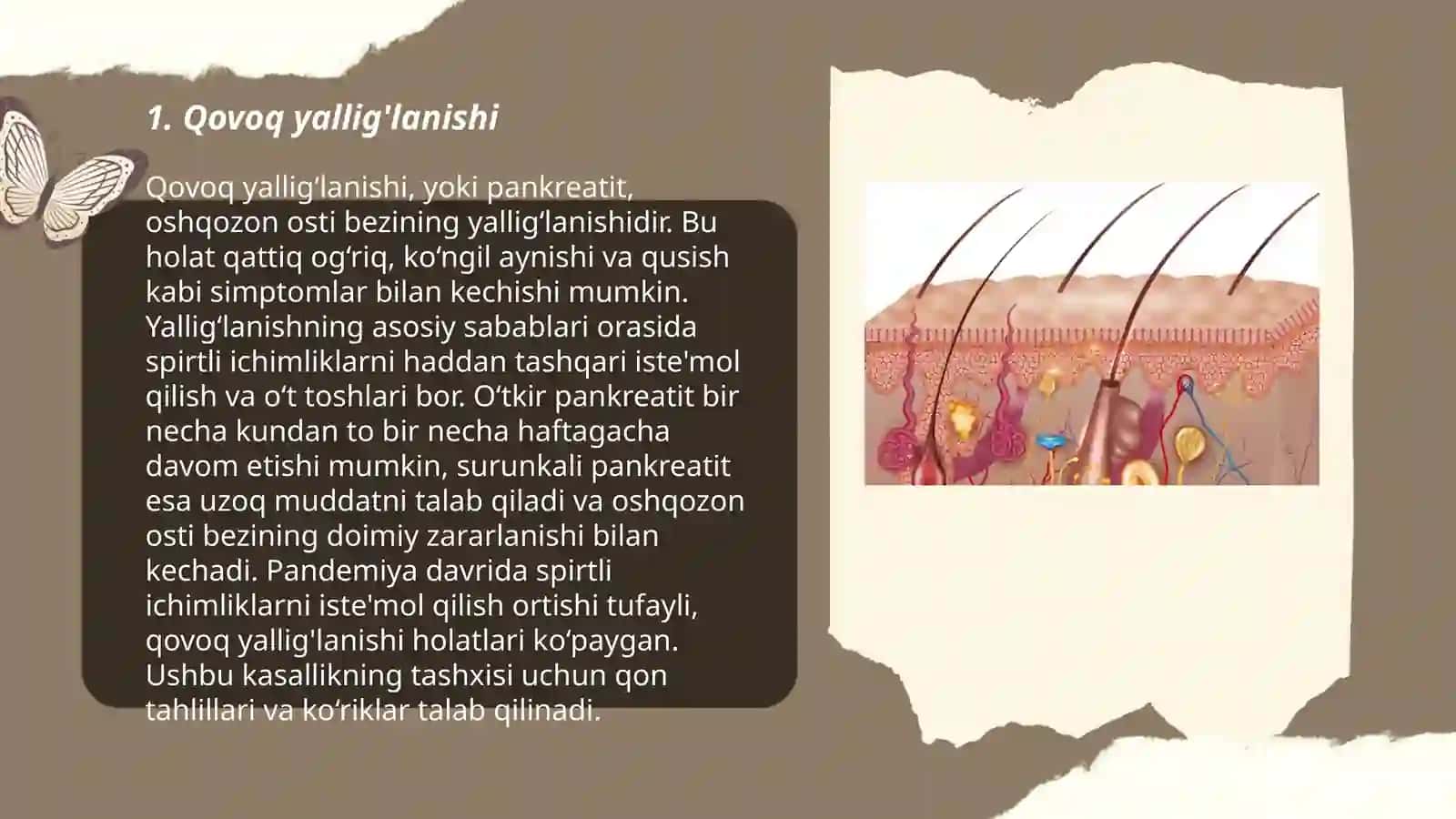 Kozning yordamchi azolari kasalliklari oftolmologiya fani 3