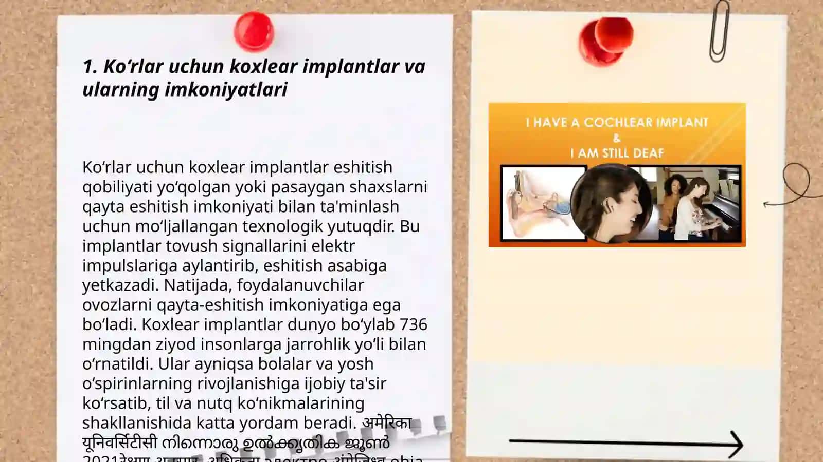 Koxlear implantli bolalar eshitish idrokini rivojlantirish metodlari 3