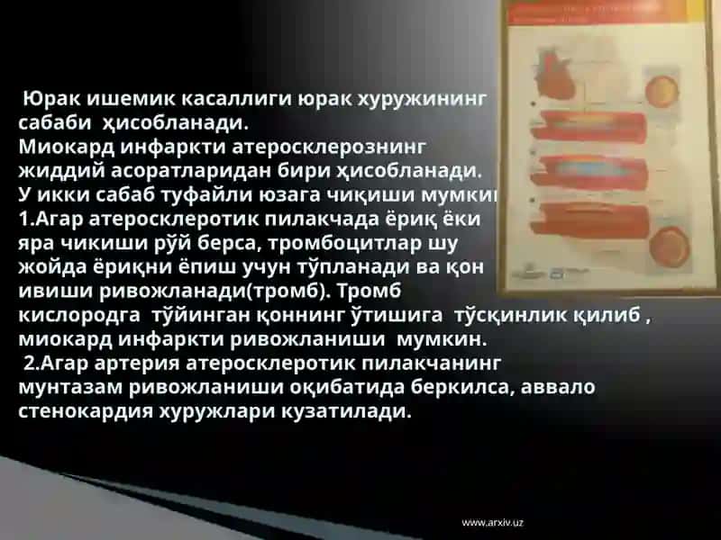Ўткир коронар синдром 3