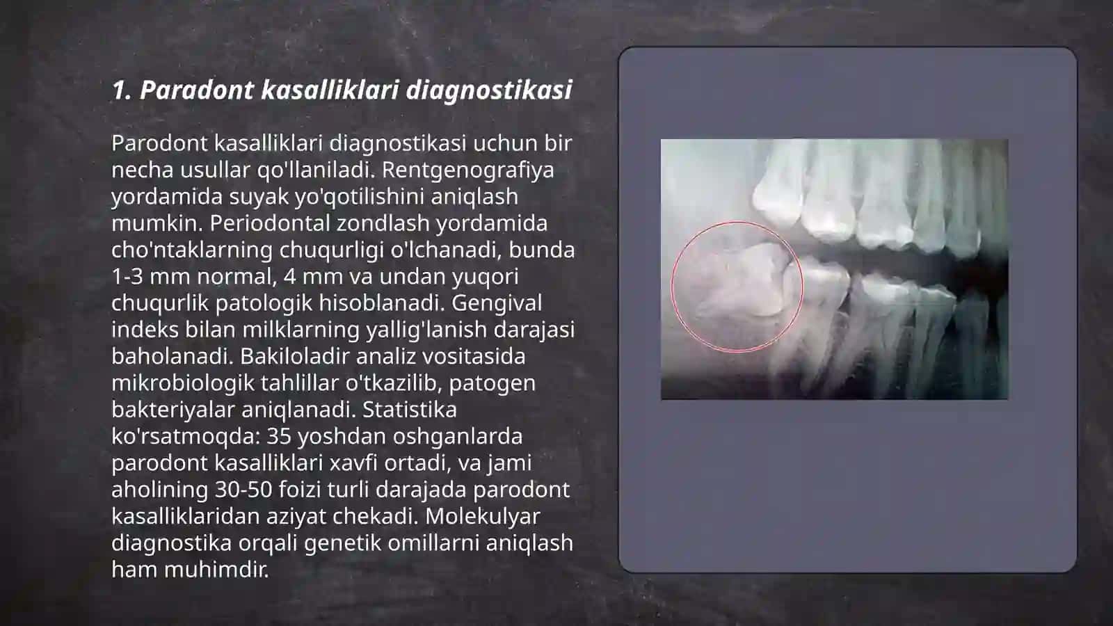 Paradont kasalliklarida rentgenogramma va ortopotomografiya 3