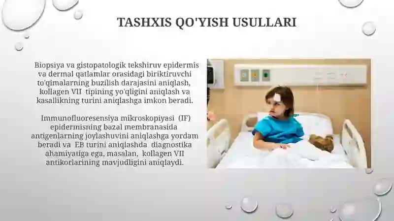 Bullyoz epidimoliz, xeyli- xeyli kasalligi 3