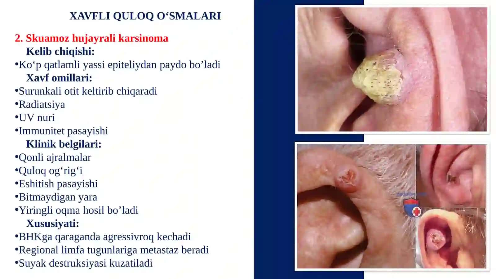 QULOQNING XAVFLI O‘SMALARI 3