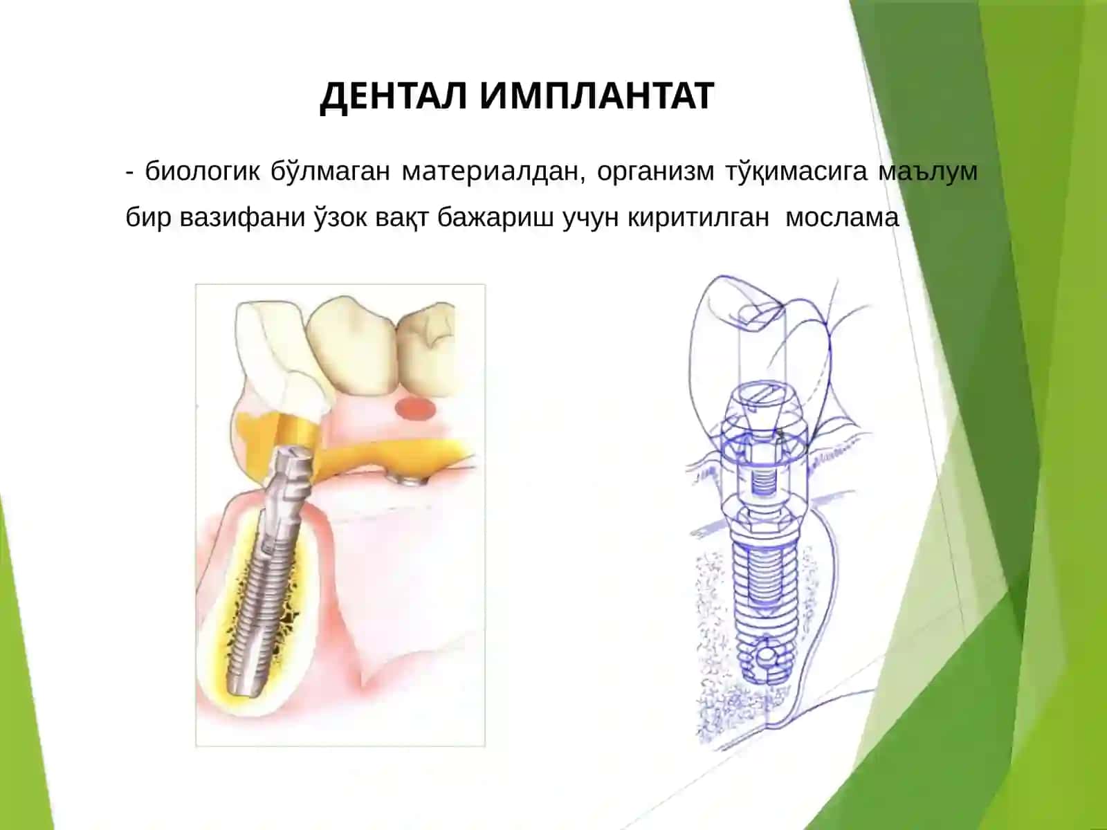 ДЕНТАЛ ИМПЛАНТАТ 3