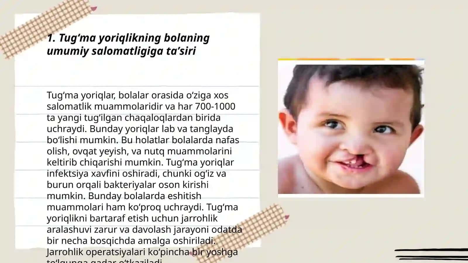 Tugʻma yoriqlikning bolaning jismony ruhiy va nutqiy rivojlanishiga tasiri 3
