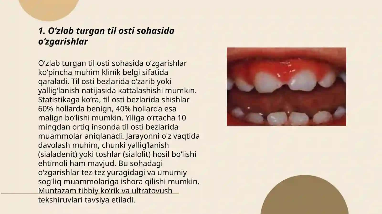 Oʻzlab Turgan Til Osti Sohasida Oʻzgarishlar 3