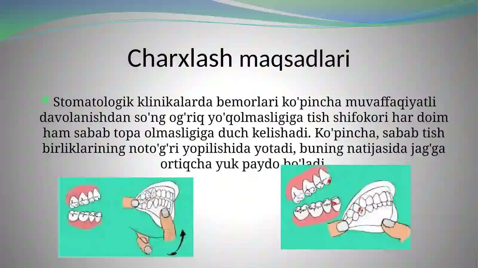 Tishlarni tanlab charxlash usuli 3