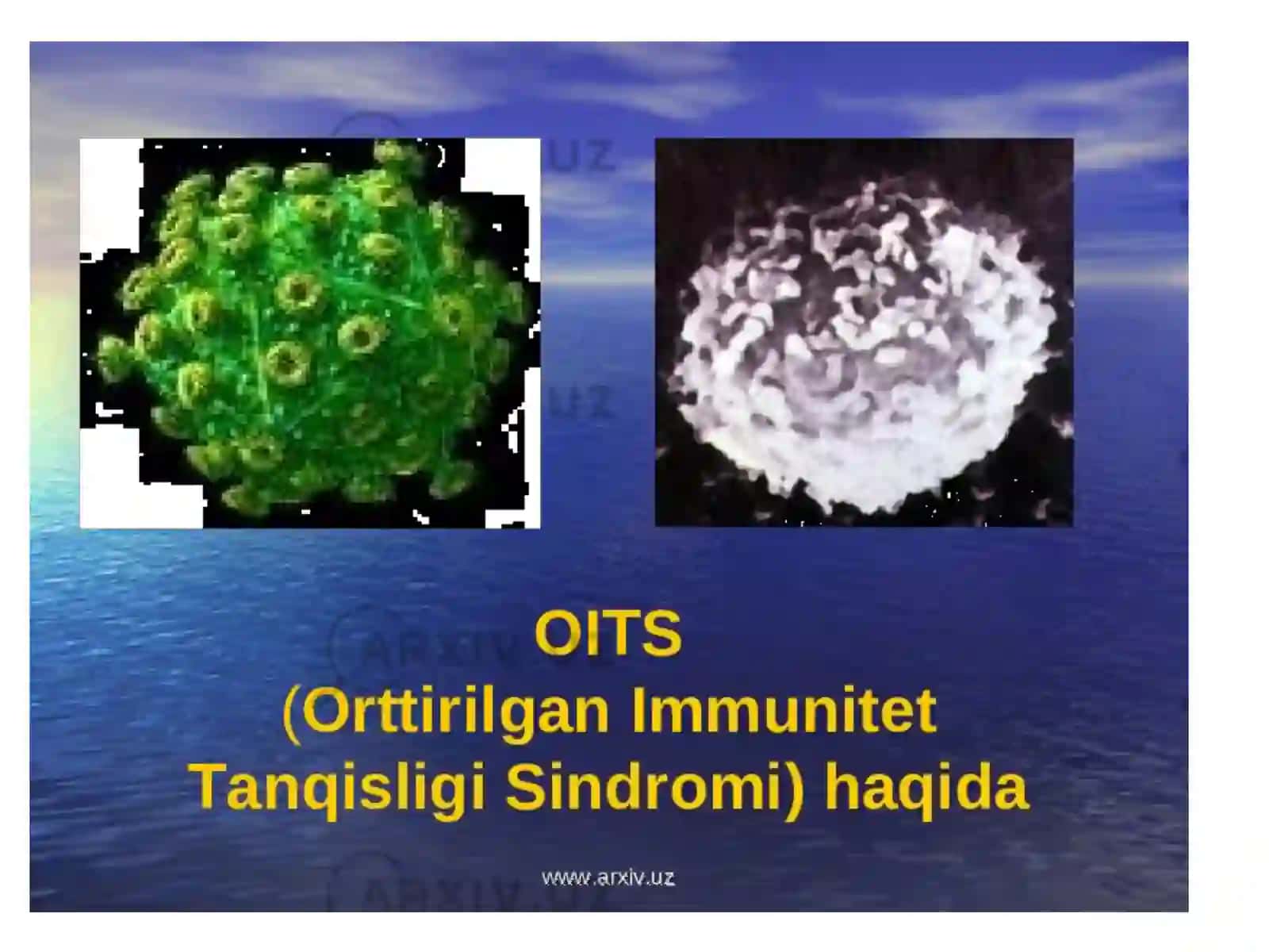 orttirilgan immun tanqisligi 3