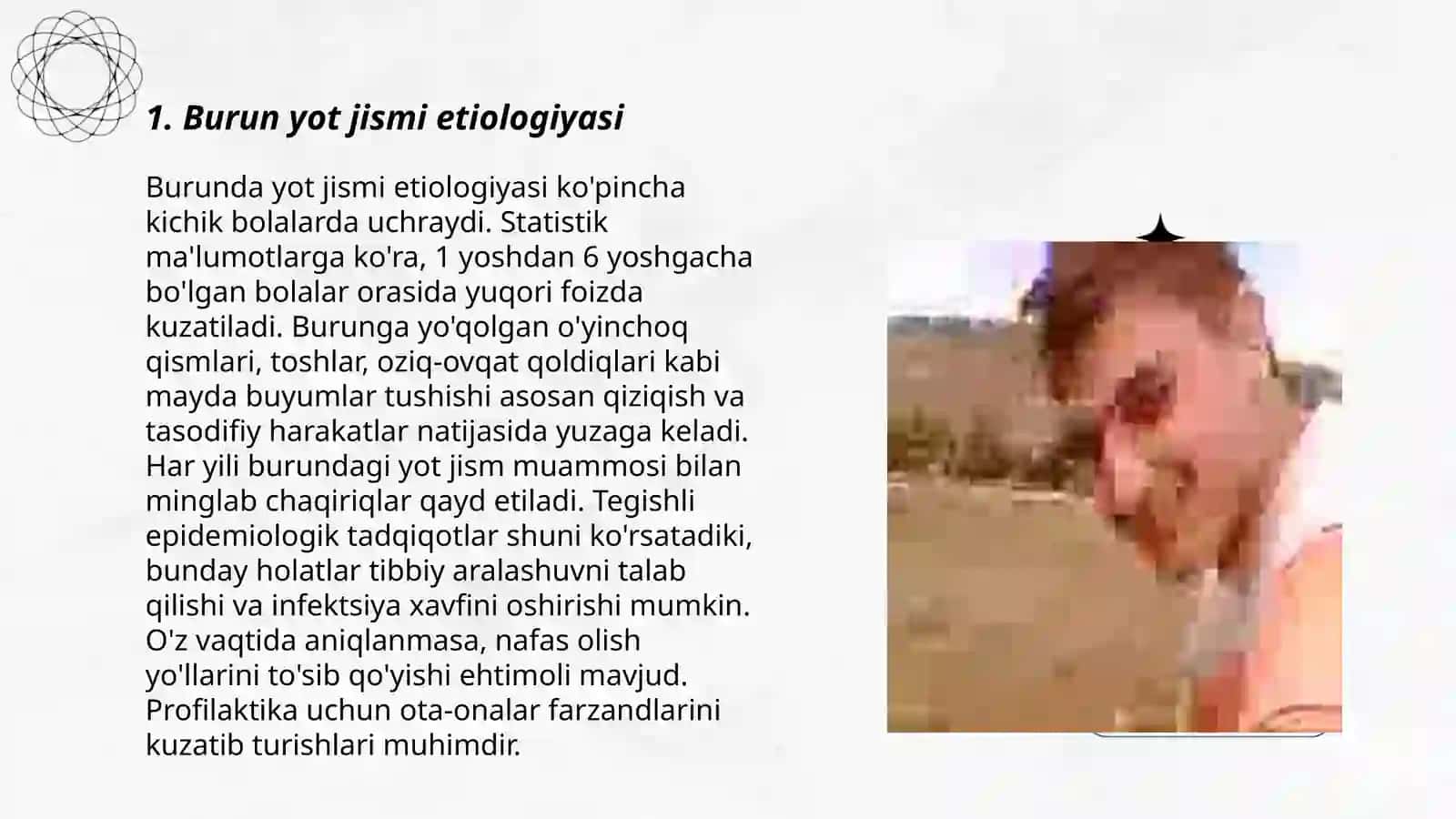 Burun yot jismi etiologiyasi, klinikasi, tashxislash, differensial tashxislash, davolash 3