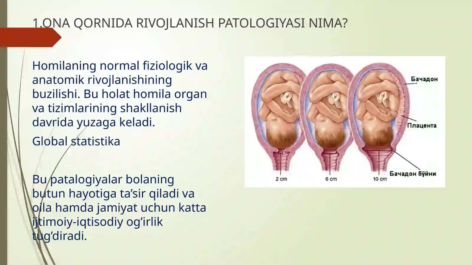 ONA QORNIDA RIVOJLANISHPATOLOGIYASINIMA 3