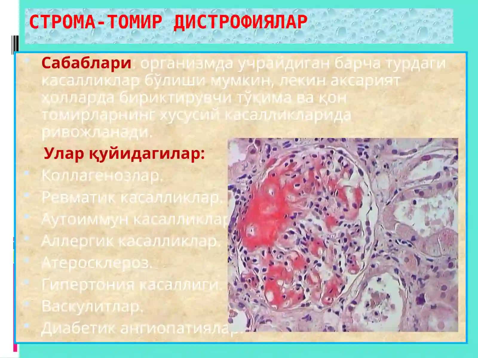 СТРОМА-ТОМИР ДИСТРОФИЯЛАР 3