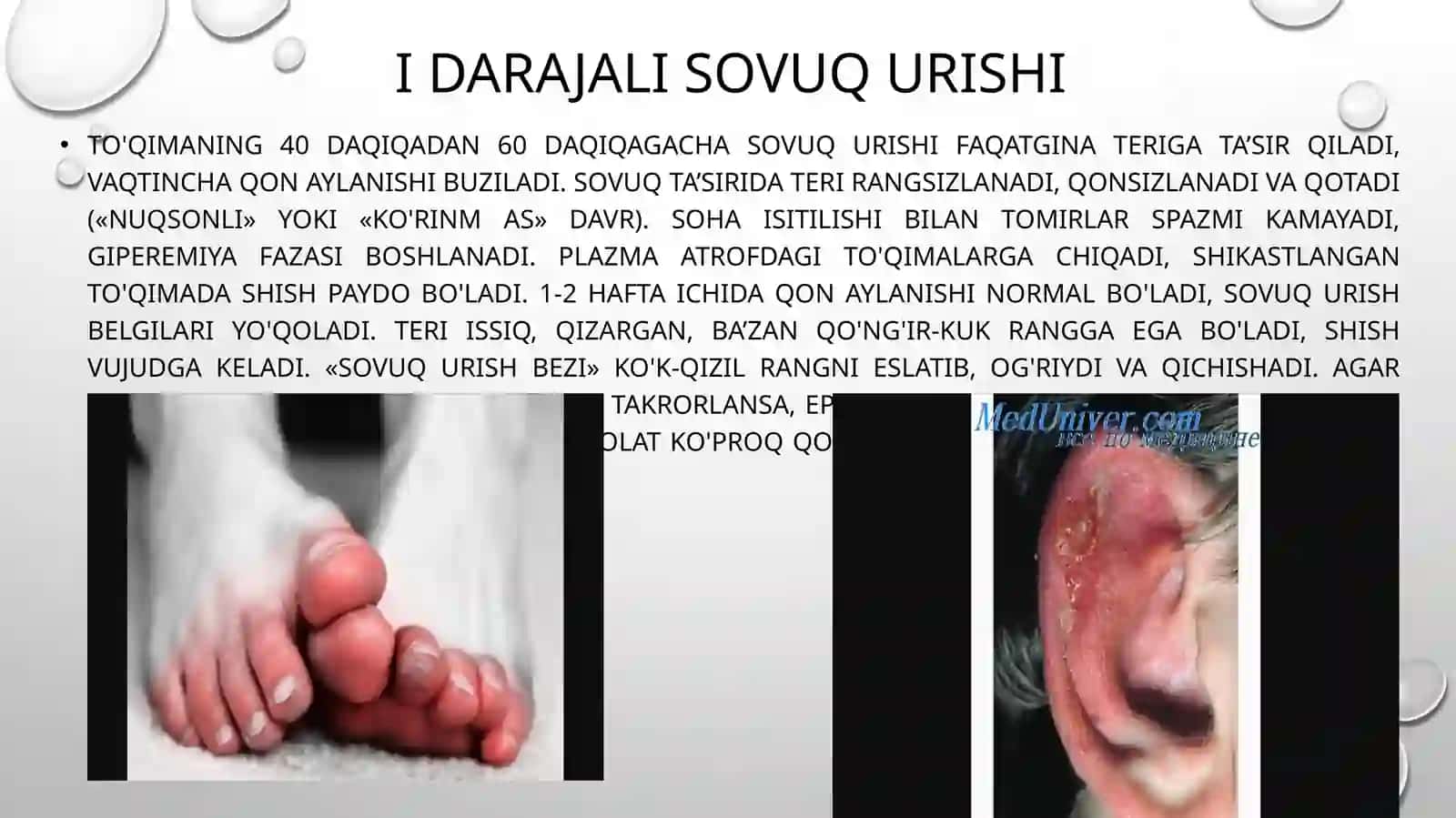Sovuq urish belgilari 3