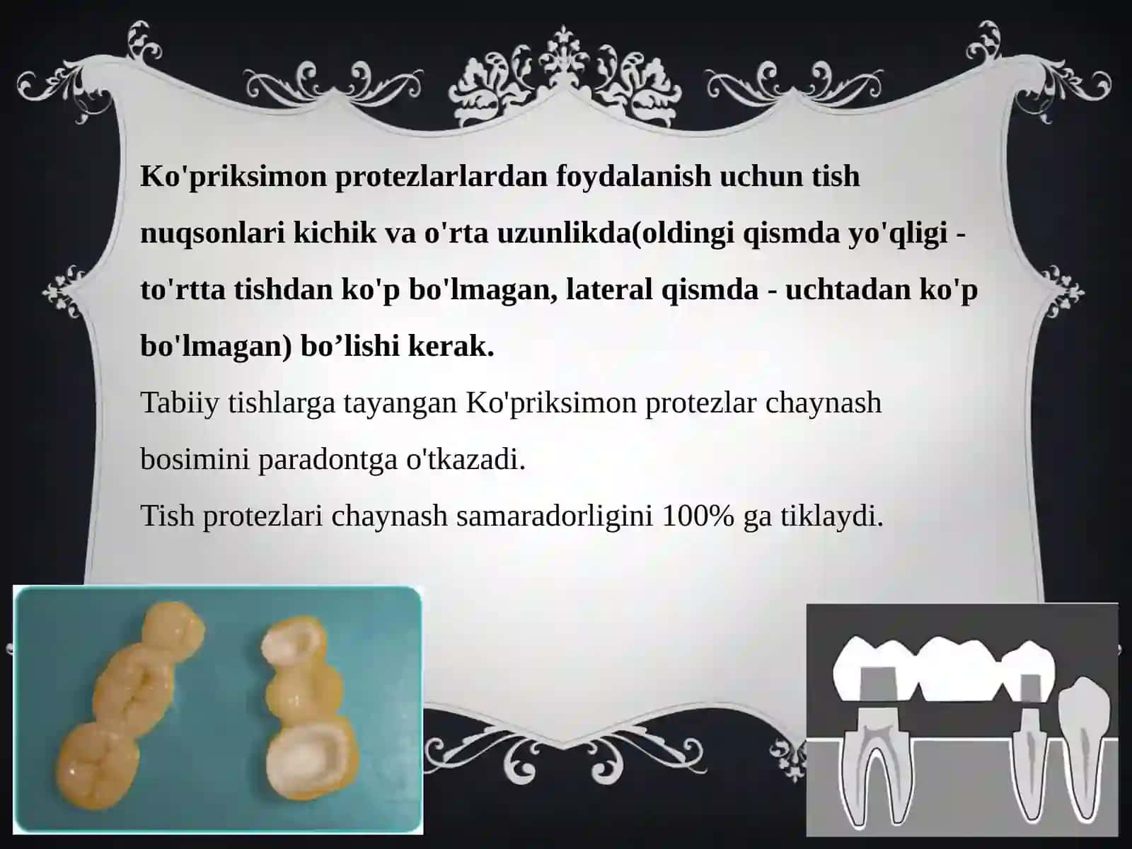 Zamonaviy ko‘priksimon protezlar 3