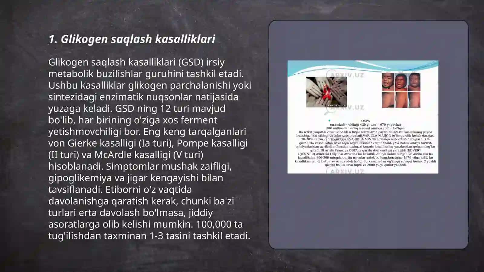 Glikogen kasaliklari 3