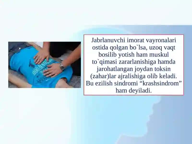 URUSH   DAVRIDA  DAVOMLI    sindromi 3
