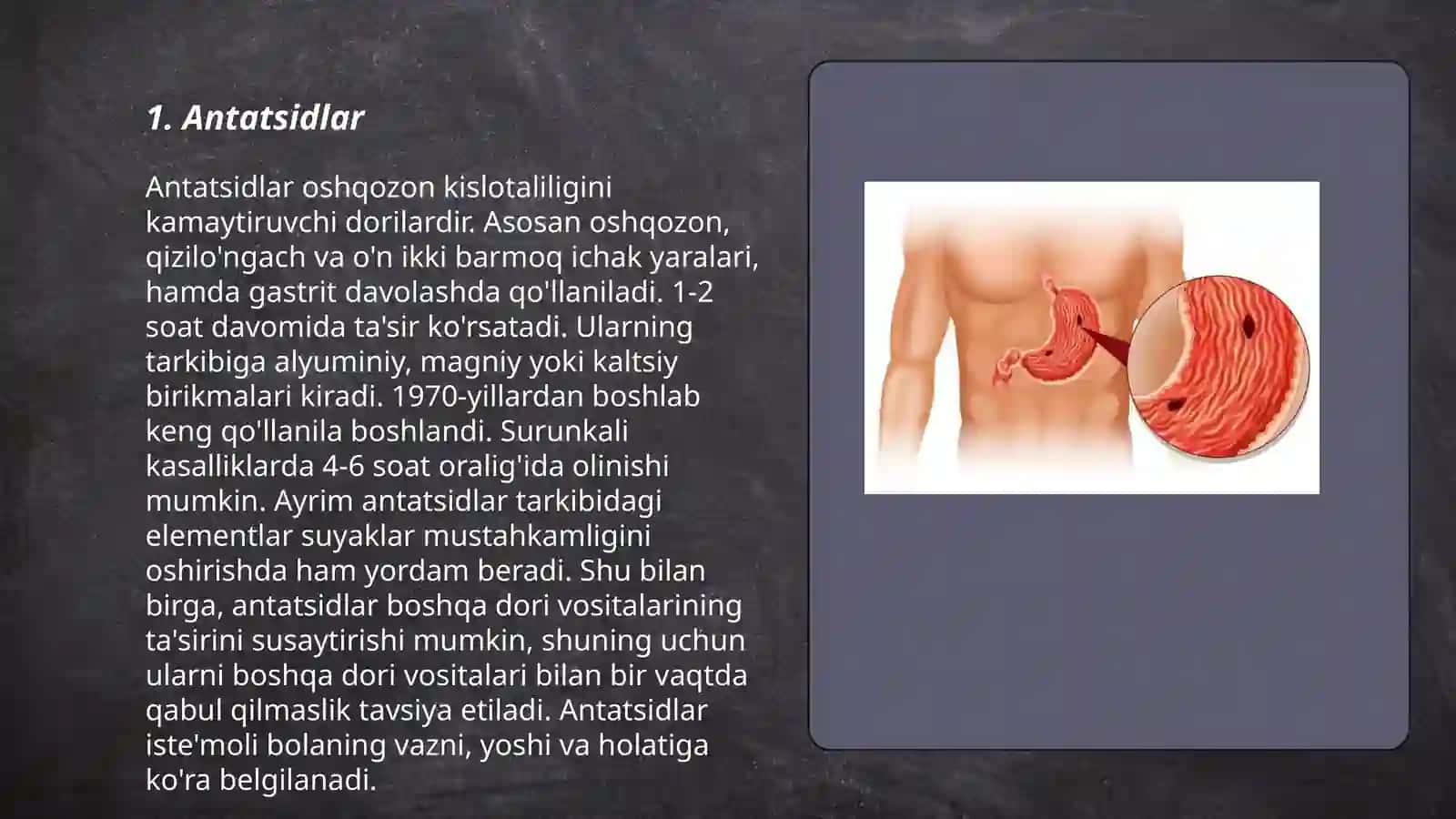 Me'da va o'n ikki barmoq ichak yarasini davolashda qoʻllaniladigan dori vositalar 3