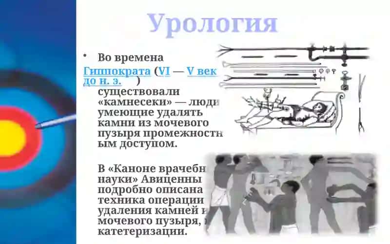 Урология 3